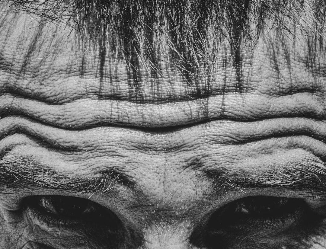 Baseline forehead showing uneven tone and dullness